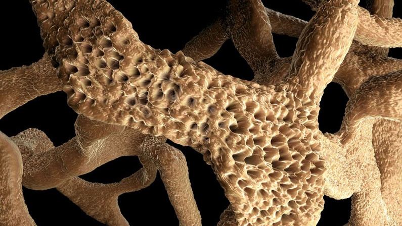 Wapres RI Ma'ruf Amin Resmikan Gerakan Nasional Melawan Osteoporosis