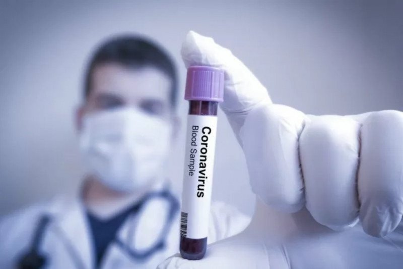Pengamat Intelijen Desak Pemerintah Buka Data Rekam Perjalanan Pasien Corona