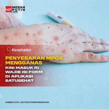 MPOX Mengganas Masuk RI Kini Pakai Aplikasi SATUSEHAT