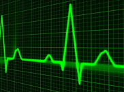 Dokter Spesialis: Gejala Serangan Jantung Bisa Dideteksi