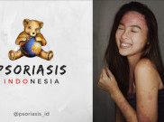 Penyintas Autoimun Negeri Aing Gemakan Kampanye Se-Asia Tenggara Hapus Stigma Negatif Psoriasis