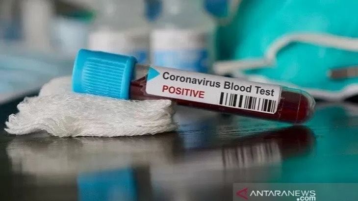 Update Kasus COVID-19 DKI Kamis (22/10): 98.206 Positif, 83.338 Orang Sembuh