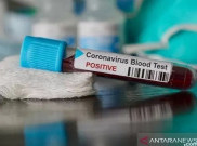 Update Kasus COVID-19 DKI Kamis (22/10): 98.206 Positif, 83.338 Orang Sembuh