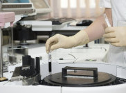 Suhu Panas dan Lembab, Alasan Indonesia Belum Ada Virus Corona