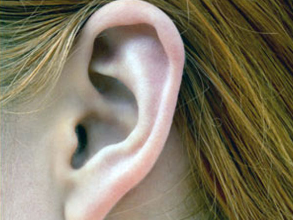 Jerawat di telinga akan sembuh sendiri (Foto: Boldsky)