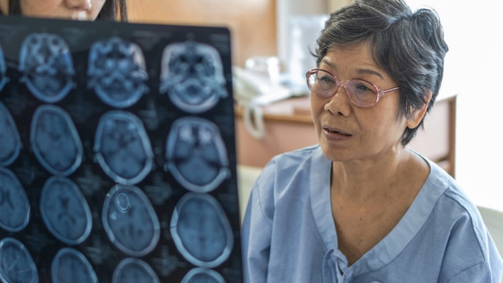 Sistem AI akan persingkat proses diagnosis demensia yang biasanya perlu beberapa kali pemindaian. (Foto: 123RF/archnoi1)