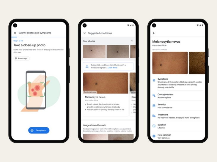 Selain menggunakan gambar, perangkat Google IO juga meminta pasien untuk menjawab serangkaian pertanyaan secara daring. (Foto: newbeauty.com)