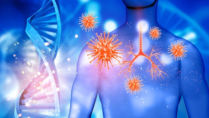 Pentingnya Pengujian Biomarker untuk Kanker Paru-Paru