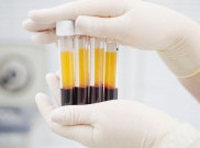 PMI Cirebon Mulai Produksi Plasma Merah buat Pasien COVID-19