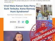 [HOAKS atau FAKTA]: Gangguan Mata Katy Perry Akibat Vaksin COVID-19