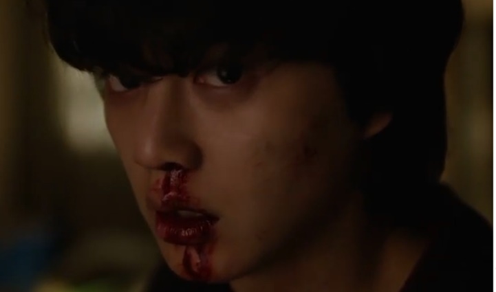 Bukan Digigit Zombie, ini 4 Penyebab Hidung Mimisan