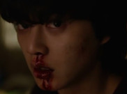 Bukan Digigit Zombie, ini 4 Penyebab Hidung Mimisan