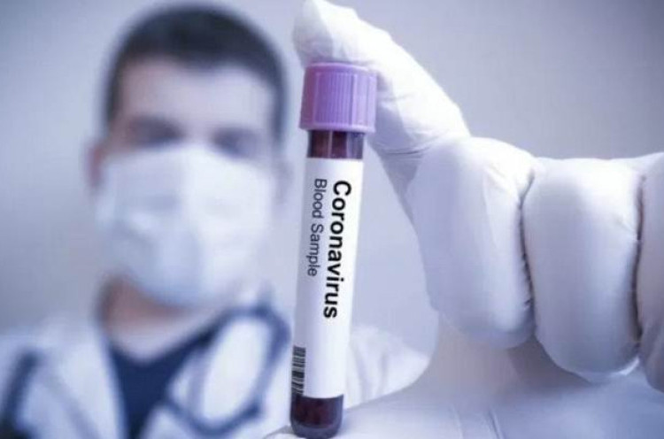 Perusahaan Biofarmasi Jepang Mulai Uji Vaksin Corona pada Hewan