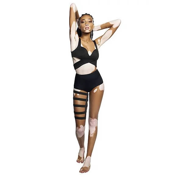 Winnie Harlow (people.com)