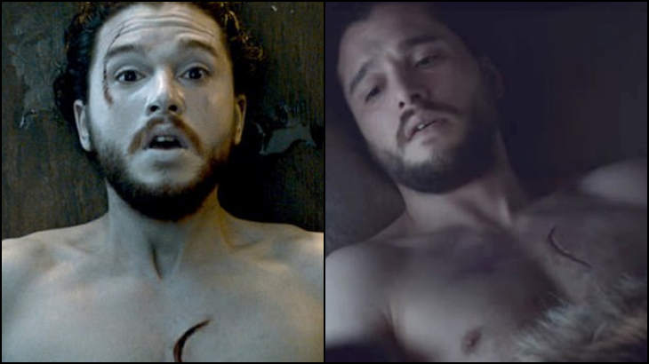 Bekas luka Jon Snow hilang (Sumber: HBO)