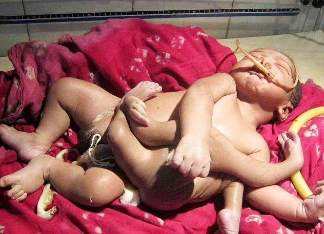 Bayi Dewa Lahir di India
