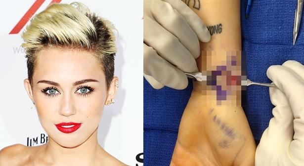 Cedera Aneh, Miley Cyrus Dilarikan Ke Rumah Sakit