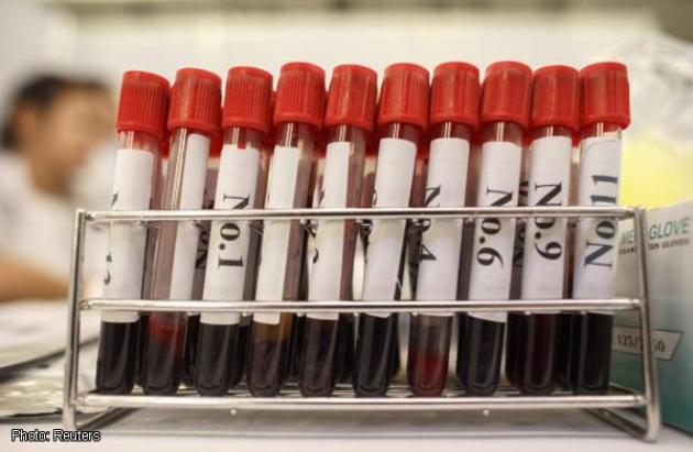 Ironi, 10 Anak Terinveksi HIV Karena Transfusi Darah