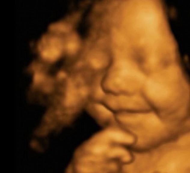 Leo Hargreaves Si Bayi Bahagia dari Inggris