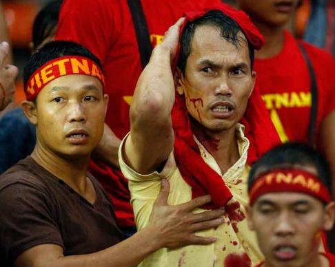 Menteri Olahraga Malaysia Minta Maaf 