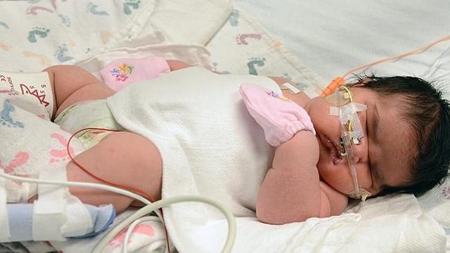 Mia Si Bayi Terbesar