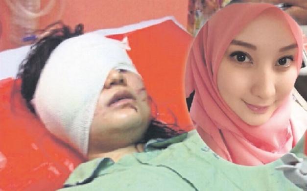 Perempuan Cantik Ini Hampir Diperkosa